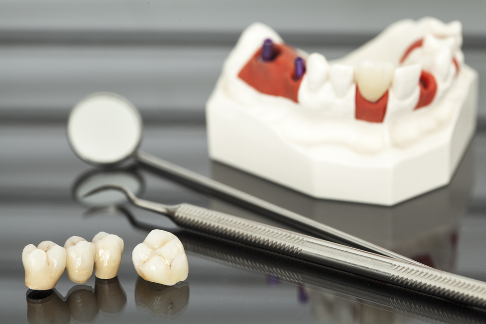 teeth bridge and dental equipment