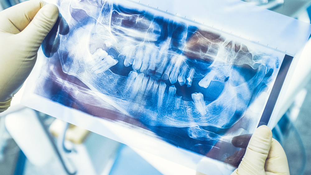 dentist holding a dental x ray