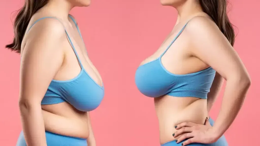 Is Breast Lift Dangerous or Healthy?
