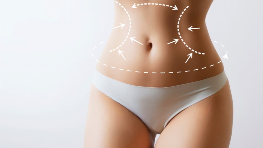 Karın Germe ile Kombine 360 Liposuction: İdeal Vücut Şeklinize Ulaşmak İçin Kapsamlı Bir Rehber
